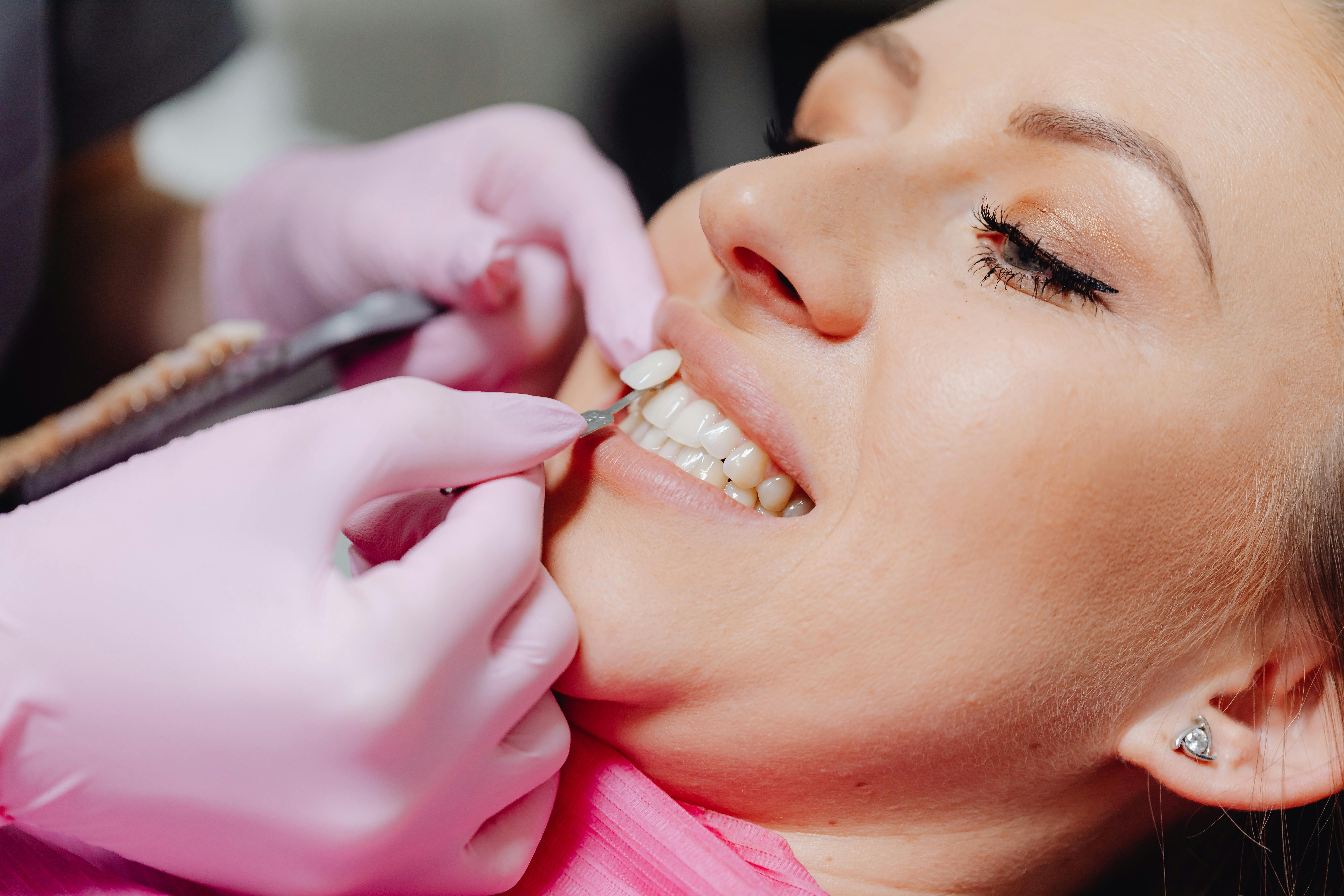 Paciente en Clínica dental realizando prueba de estética dental para ortodoncia invisible para adultos.