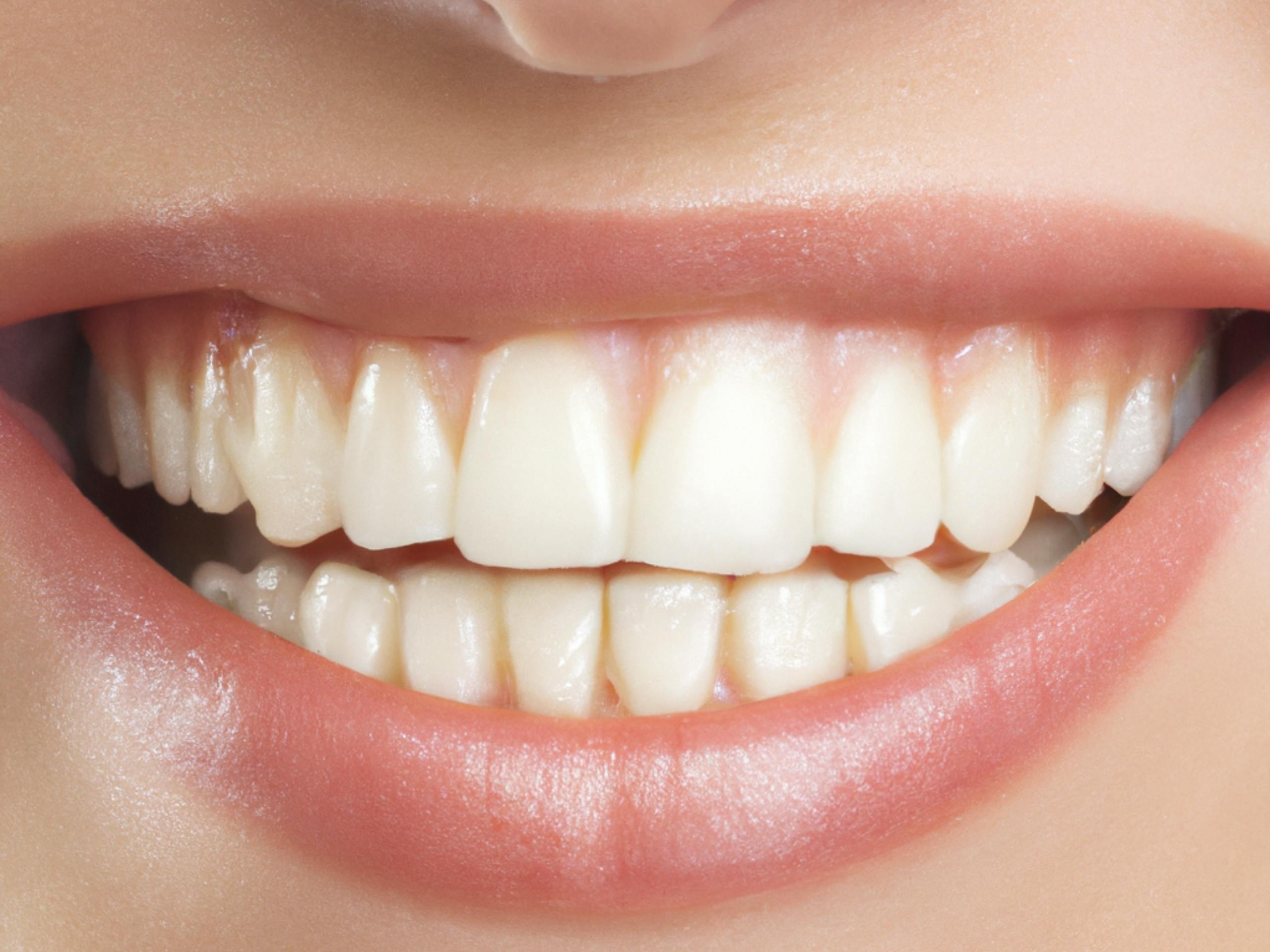 Primer plano de una sonrisa natural y saludable con dientes blancos, relacionada con la autoestima y el bienestar personal.