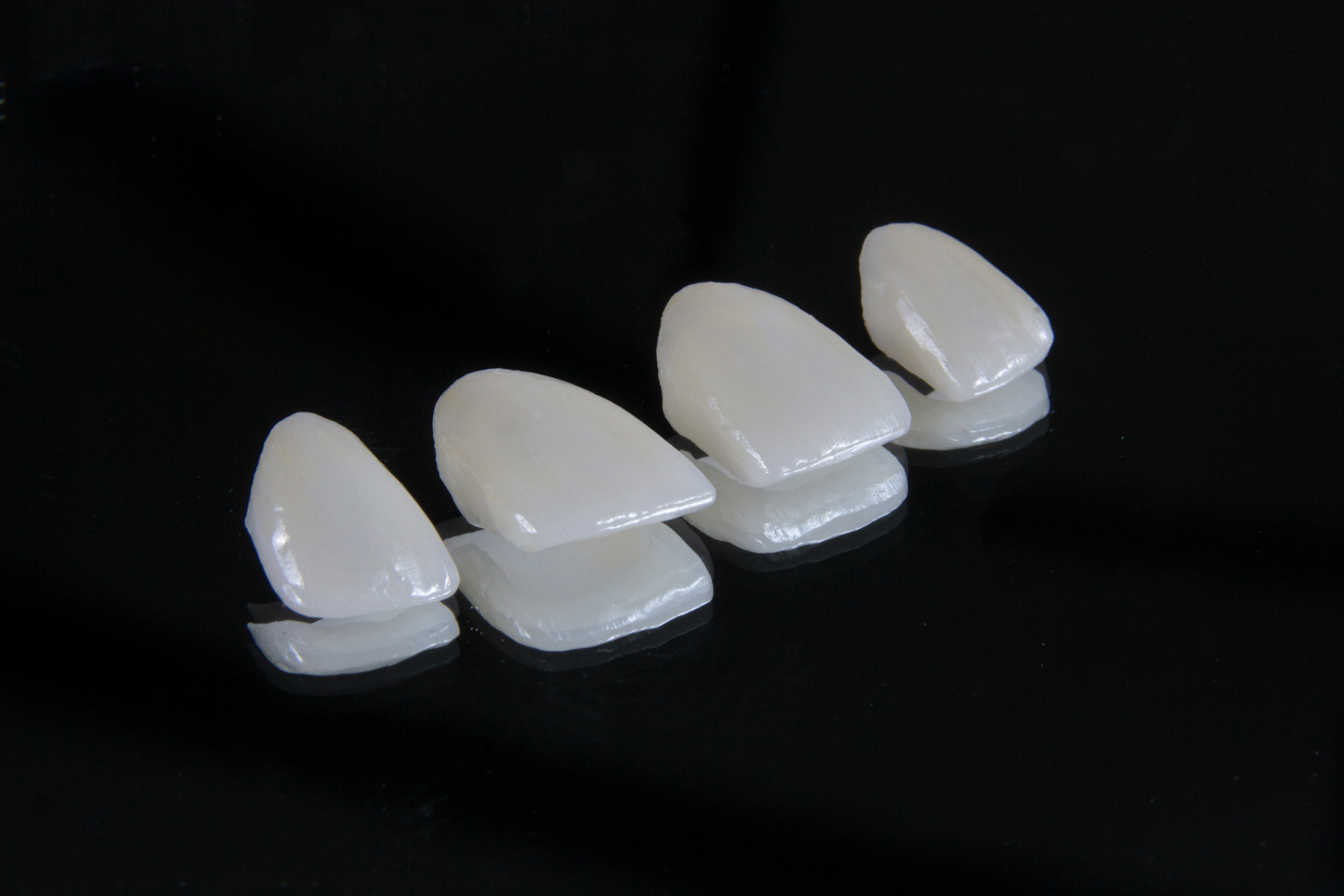 Carillas de porcelana vs. Composite: ¿Cuál es la mejor opción para transformar tu sonrisa?