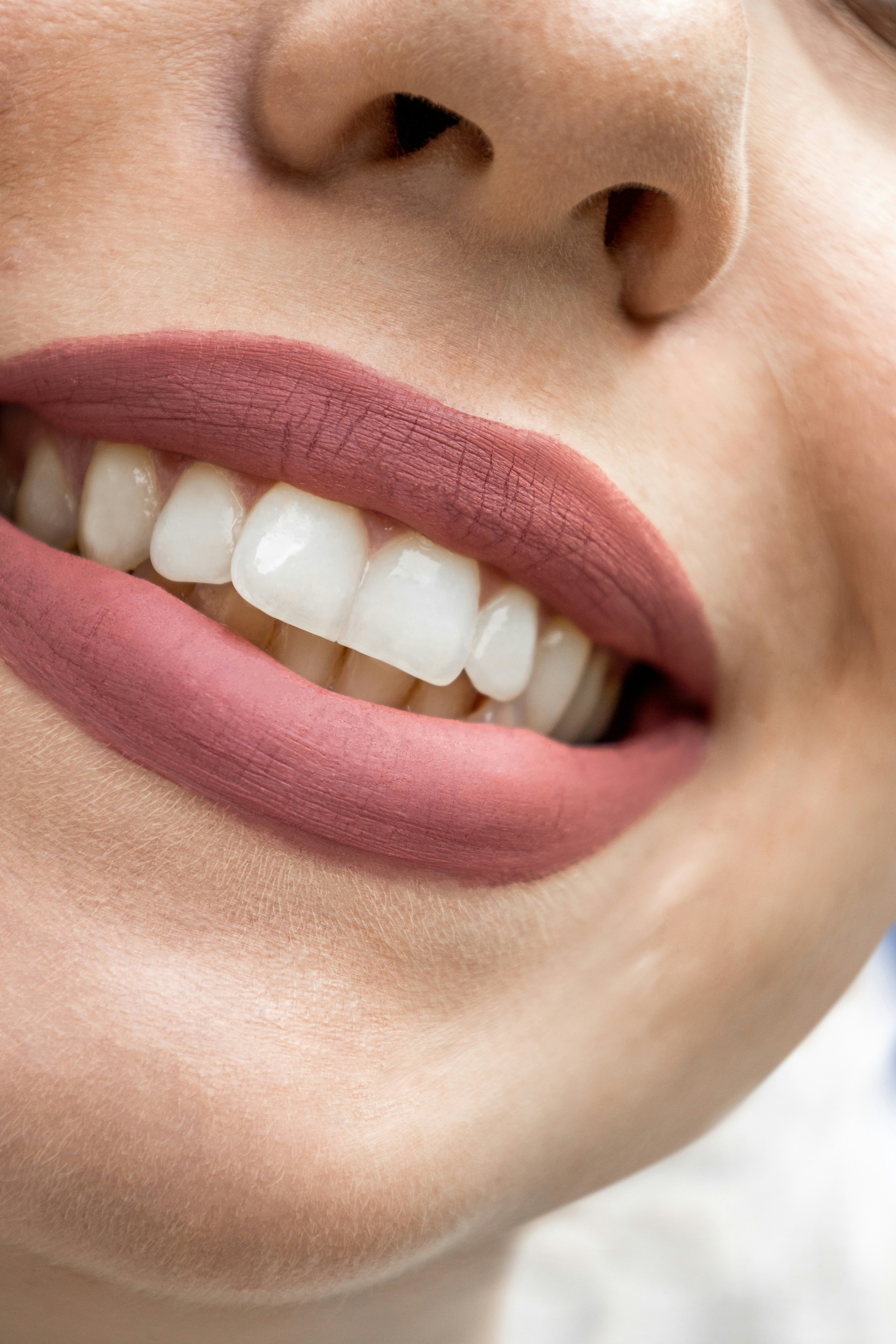 Cómo saber si un tratamiento estético se verá natural: 5 claves antes de decidir