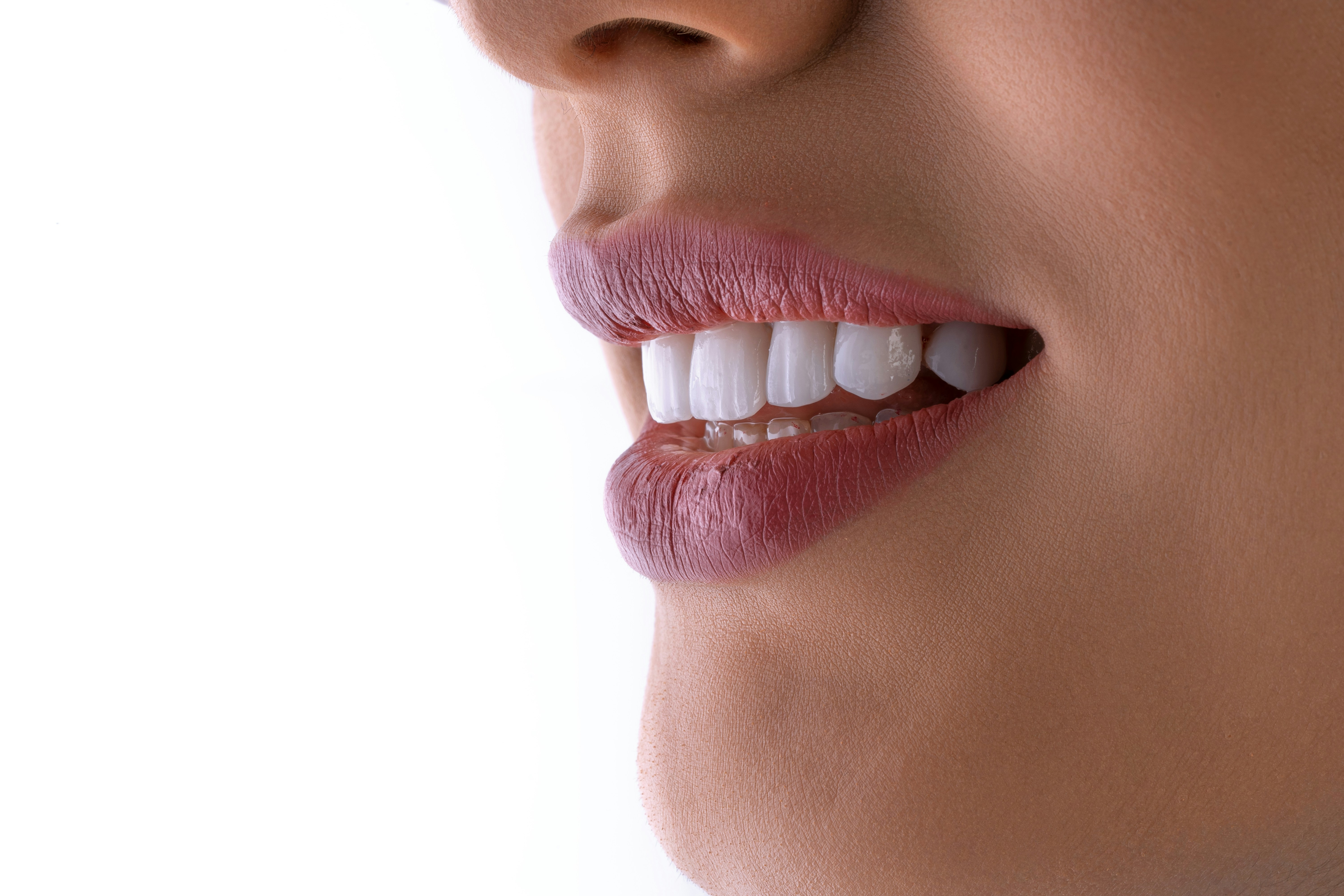 Carillas dentales para renovar tu sonrisa: Estrena imagen perfecta tras las vacaciones