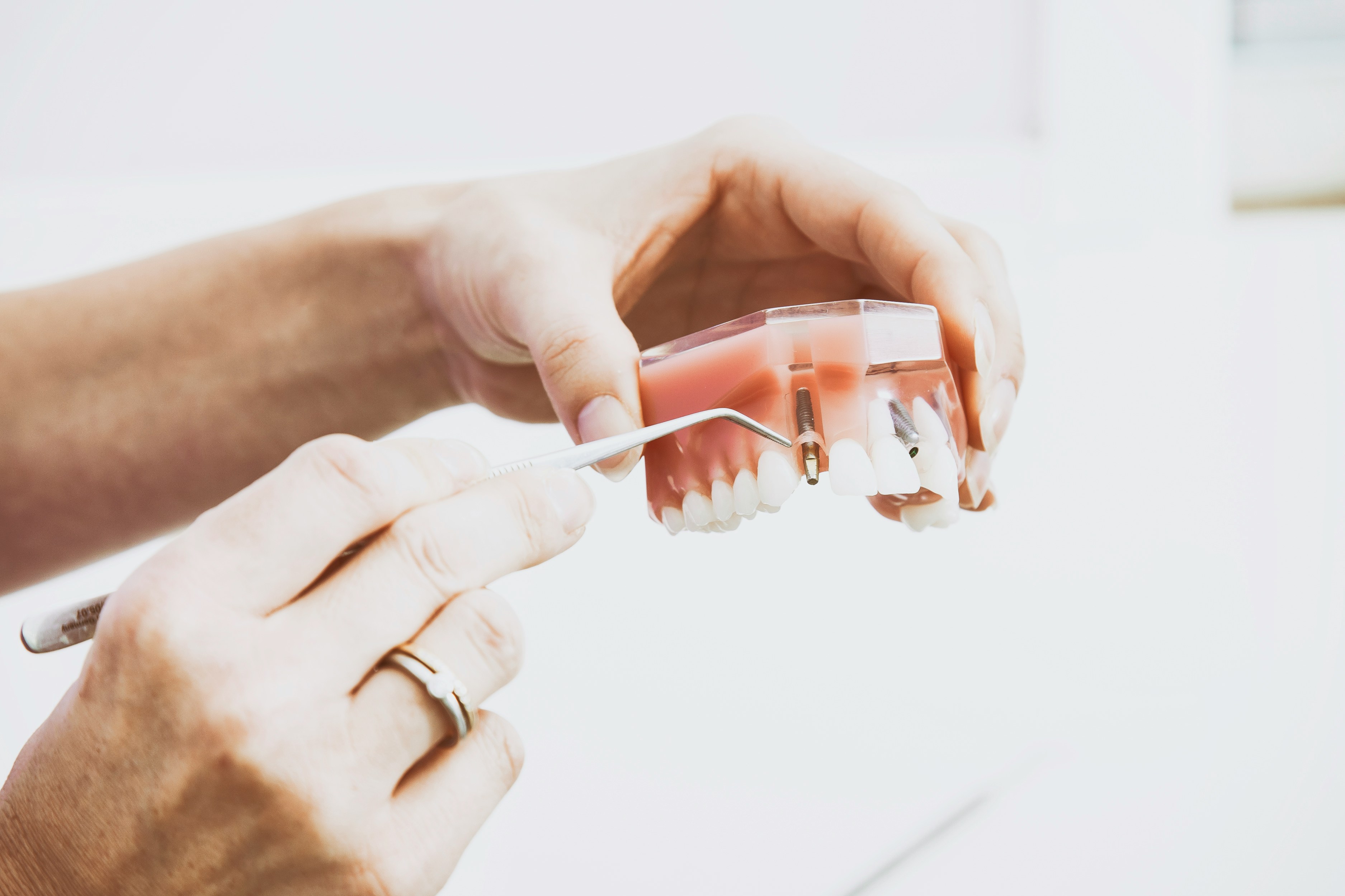 Sensibilidad dental después del verano: ¿Por qué duelen los dientes con el frío?